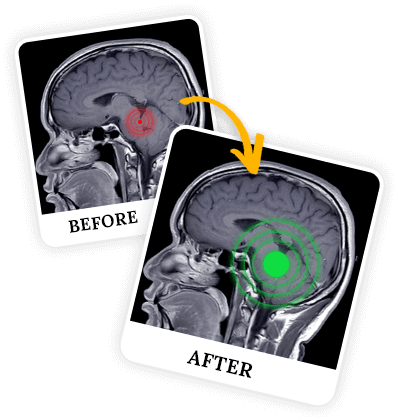 Billionaire-Brain-Wave-Programs
